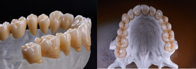 Синтерување цирконски стоматолошки материјали CAD CAM глодање блокови од забен цирконија за D98 систем (4)