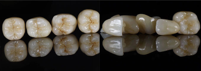 Slinování zirkonových dentálních materiálů CAD CAM frézování dentálních zirkonových bloků pro systém D98 (5)