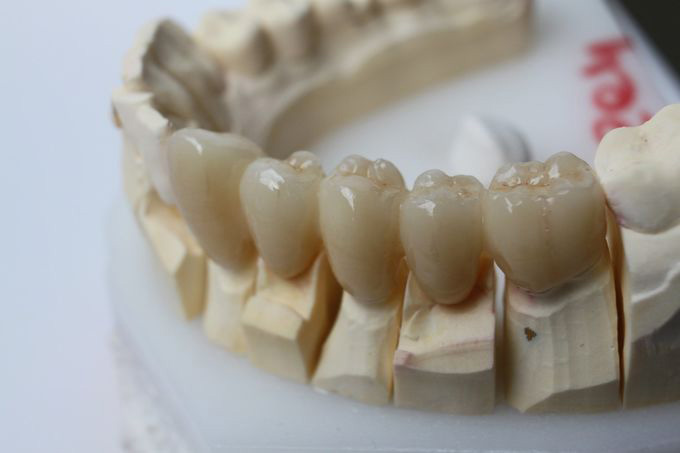 YUCERA fabbricante di materiali dentali è apparecchiature di zirconia multistrati pre-ombra (4)