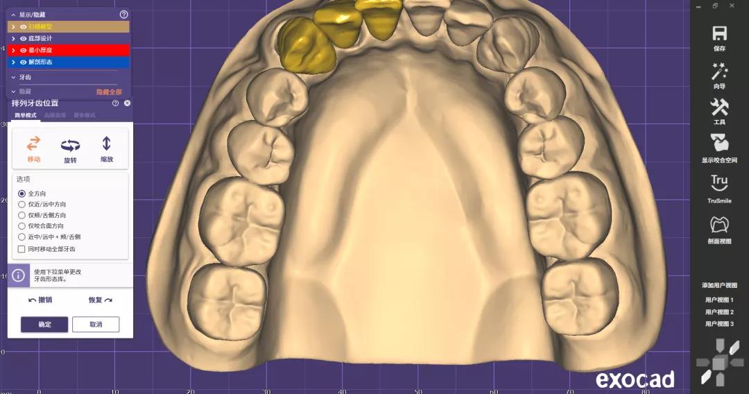 dental zirconia 