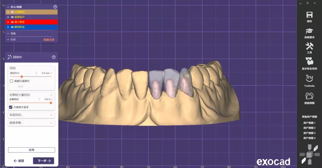 zirconia dental